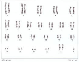 Caryotype de l'enfant a naître